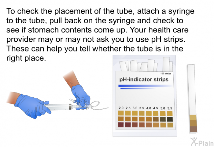 To check the placement of the tube, attach a syringe to the tube, pull back on the syringe and check to see if stomach contents come up. Your health care provider may or may not ask you to use pH strips. These can help you tell whether the tube is in the right place.