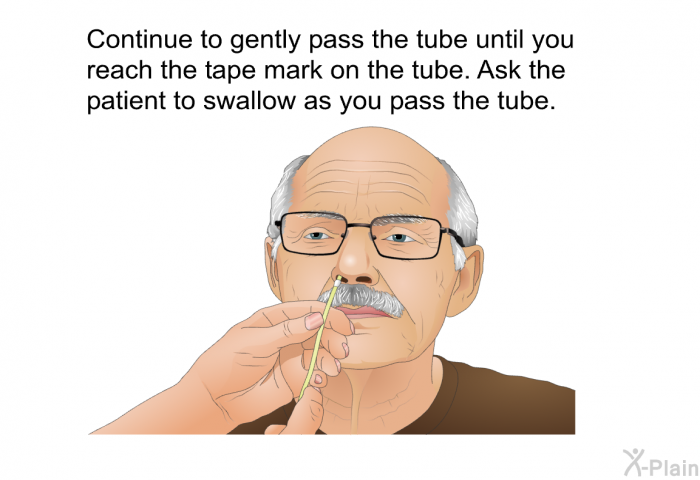 Continue to gently pass the tube until you reach the tape mark on the tube. Ask the patient to swallow as you pass the tube.