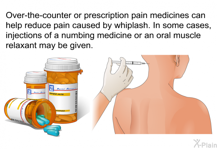 Over-the-counter or prescription pain medicines can help reduce pain caused by whiplash. In some cases, injections of a numbing medicine or an oral muscle relaxant may be given.