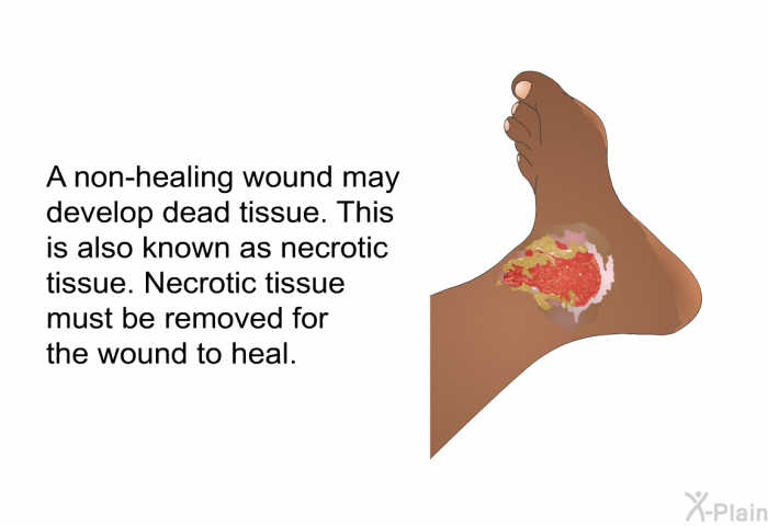 A non-healing wound may develop dead tissue. This is also known as necrotic tissue. Necrotic tissue must be removed for the wound to heal.
