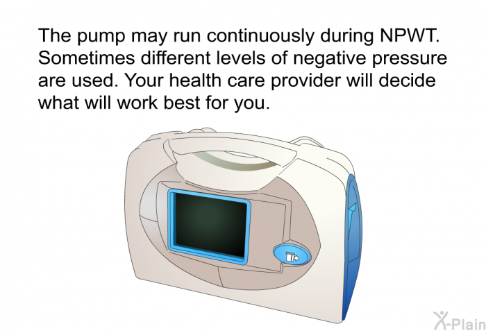 The pump may run continuously during NPWT. Sometimes different levels of negative pressure are used. Your health care provider will decide what will work best for you.