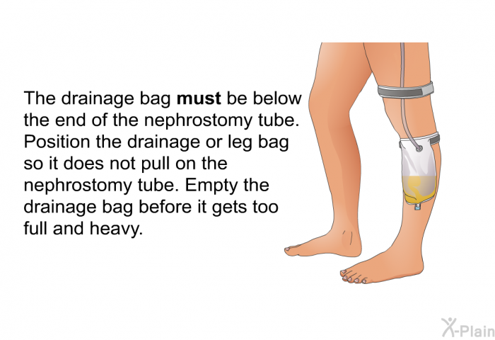 The drainage bag <B>must</B> be below the end of the nephrostomy tube. Position the drainage or leg bag so it does not pull on the nephrostomy tube. Empty the drainage bag before it gets too full and heavy.