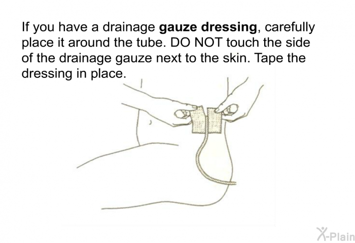If you have a drainage <B>gauze dressing</B>, carefully place it around the tube. DO NOT touch the side of the drainage gauze next to the skin. Tape the dressing in place.