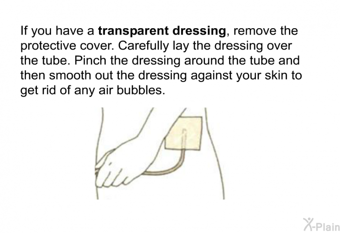 If you have a <B>transparent dressing</B>, remove the protective cover. Carefully lay the dressing over the tube. Pinch the dressing around the tube and then smooth out the dressing against your skin to get rid of any air bubbles.