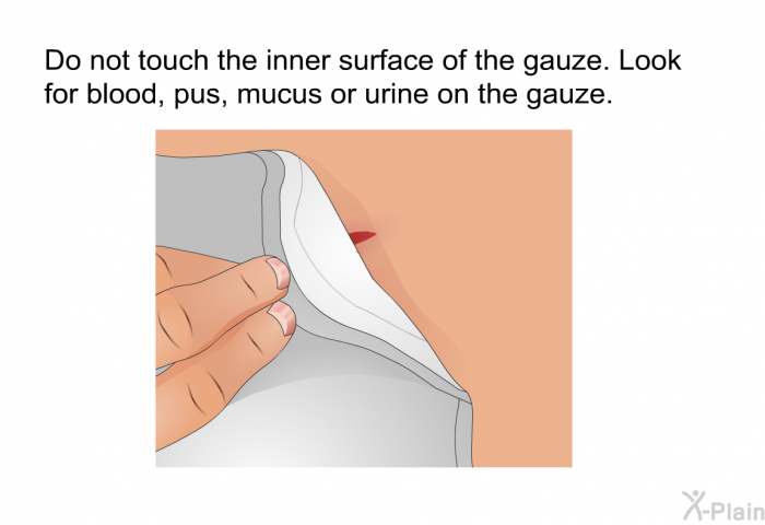 Do not touch the inner surface of the gauze. Look for blood, pus, mucus or urine on the gauze.