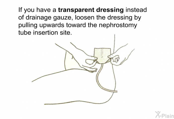 If you have a <B>transparent dressing</B> instead of drainage gauze, loosen the dressing by pulling upwards toward the nephrostomy tube insertion site.