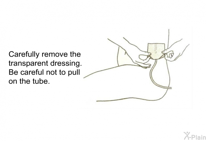 Carefully remove the transparent dressing. Be careful not to pull on the tube.