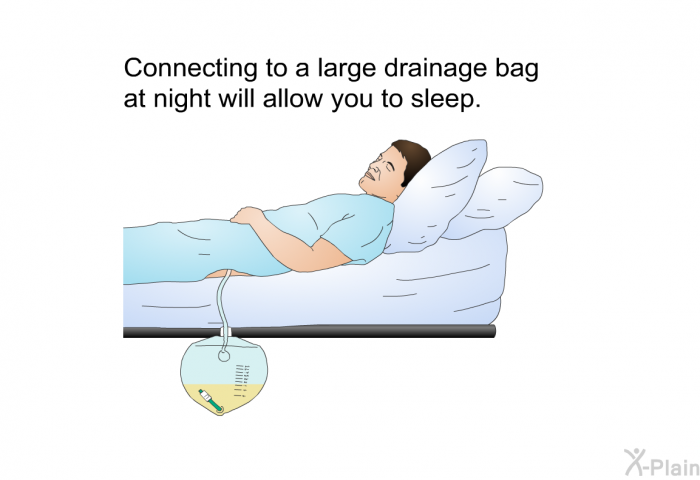 Connecting to a large drainage bag at night will allow you to sleep.