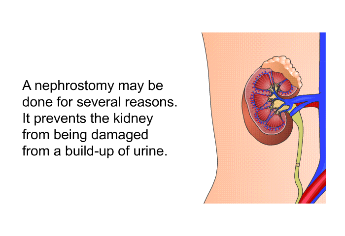 A nephrostomy may be done for several reasons. It prevents the kidney from being damaged from a build-up of urine.