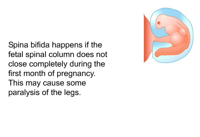 Spina bifida happens if the fetal spinal column does not close completely during the first month of pregnancy. This may cause some paralysis of the legs.