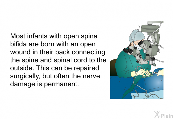 Most infants with open spina bifida are born with an open wound in their back connecting the spine and spinal cord to the outside. This can be repaired surgically, but often the nerve damage is permanent.