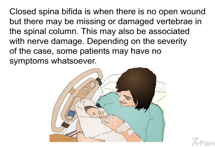 Closed spina bifida is when there is no open wound but there may be missing or damaged vertebrae in the spinal column. This may also be associated with nerve damage. Depending on the severity of the case, some patients may have no symptoms whatsoever.
