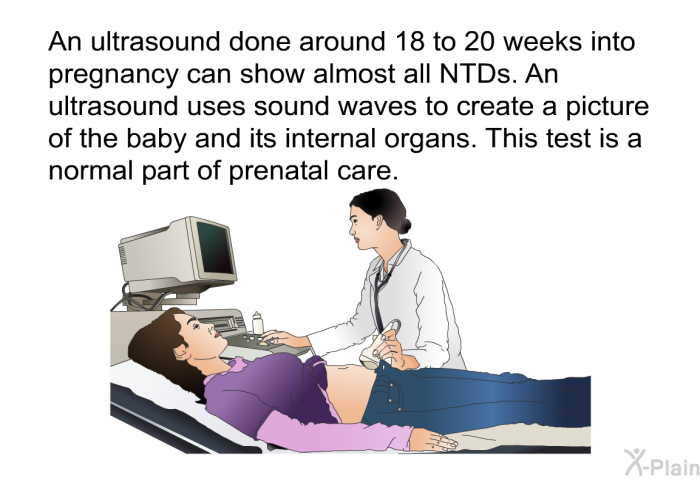 An ultrasound done around 18 to 20 weeks into pregnancy can show almost all NTDs. An ultrasound uses sound waves to create a picture of the baby and its internal organs. This test is a normal part of prenatal care.