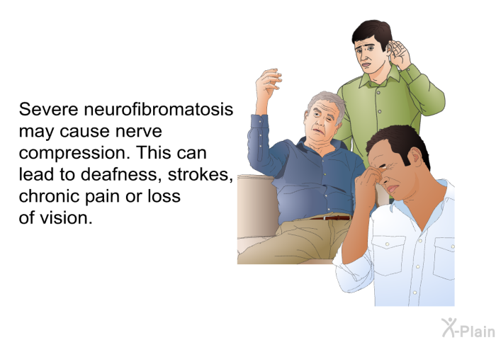 Severe neurofibromatosis may cause nerve compression. This can lead to deafness, strokes, chronic pain or loss of vision.