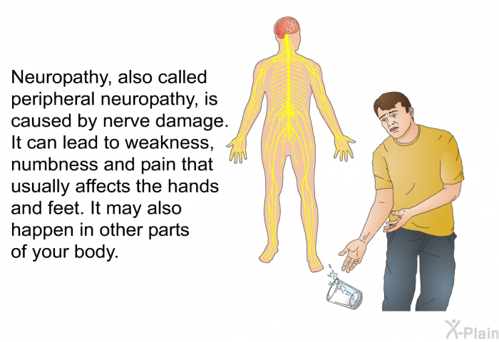Neuropathy, also called peripheral neuropathy, is caused by nerve damage. It can lead to weakness, numbness and pain that usually affects the hands and feet. It may also happen in other parts of your body.