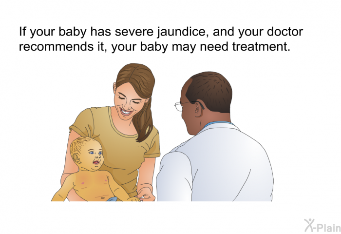 If your baby has severe jaundice, and your doctor recommends it, your baby may need treatment.