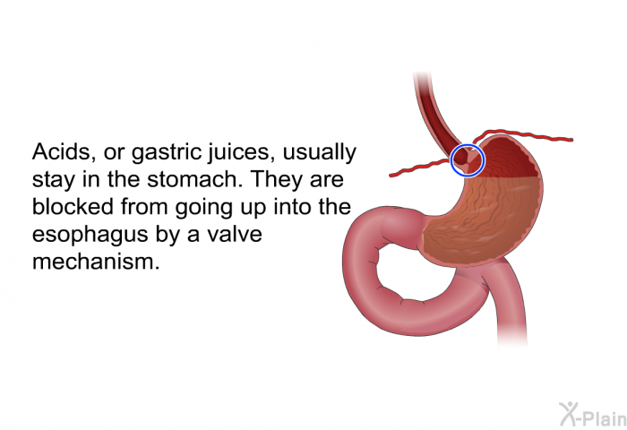 Acids, or gastric juices, usually stay in the stomach. They are blocked from going up into the esophagus by a valve mechanism.