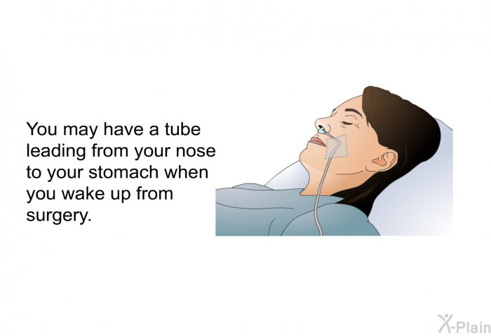 You may have a tube leading from your nose to your stomach when you wake up from surgery.