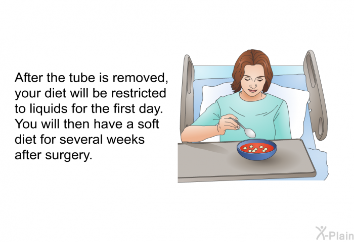 After the tube is removed, your diet will be restricted to liquids for the first day. You will then have a soft diet for several weeks after surgery.