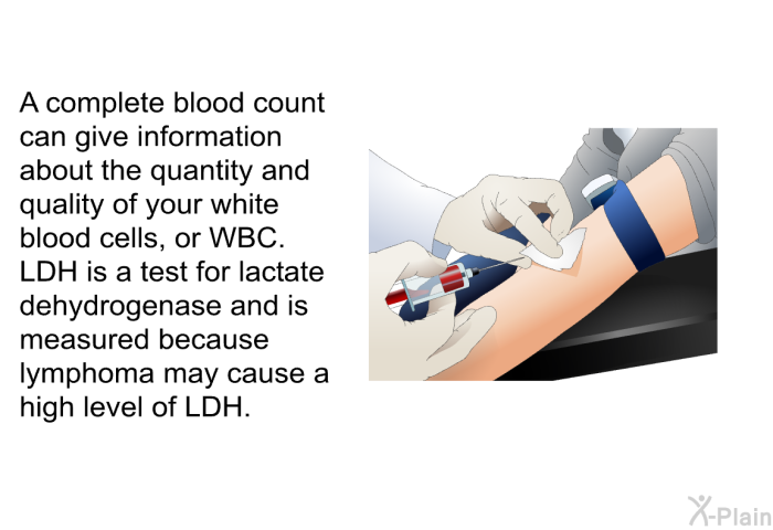 A complete blood count can give information about the quantity and quality of your white blood cells, or WBC. LDH is a test for lactate dehydrogenase and is measured because lymphoma may cause a high level of LDH.