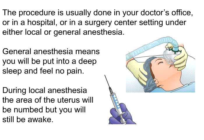 The procedure is usually done in your doctor's office, or in a hospital, or in a surgery center setting under either local or general anesthesia. General anesthesia means you will be put into a deep sleep and feel no pain. During local anesthesia the area of the uterus will be numbed but you will still be awake.