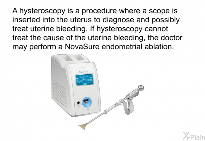 A hysteroscopy is a procedure where a scope is inserted into the uterus to diagnose and possibly treat uterine bleeding. If hysteroscopy cannot treat the cause of the uterine bleeding, the doctor may perform a NovaSure endometrial ablation.