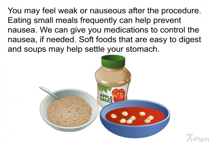 You may feel weak or nauseous after the procedure. Eating small meals frequently can help prevent nausea. We can give you medications to control the nausea, if needed. Soft foods that are easy to digest and soups may help settle your stomach.