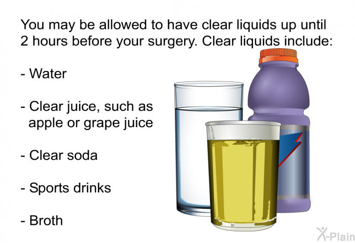 You may be allowed to have clear liquids up until 2 hours before your surgery. Clear liquids include:  Water Clear juice, such as apple or grape juice Clear soda Sports drinks Broth