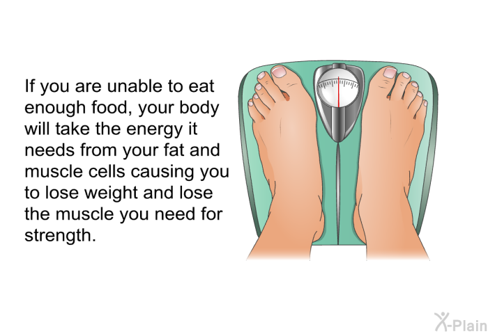 If you are unable to eat enough food, your body will take the energy it needs from your fat and muscle cells causing you to lose weight and lose the muscle you need for strength.