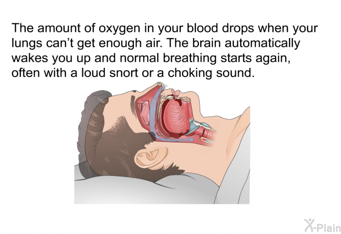 The amount of oxygen in your blood drops when your lungs can't get enough air. The brain automatically wakes you up and normal breathing starts again, often with a loud snort or a choking sound.