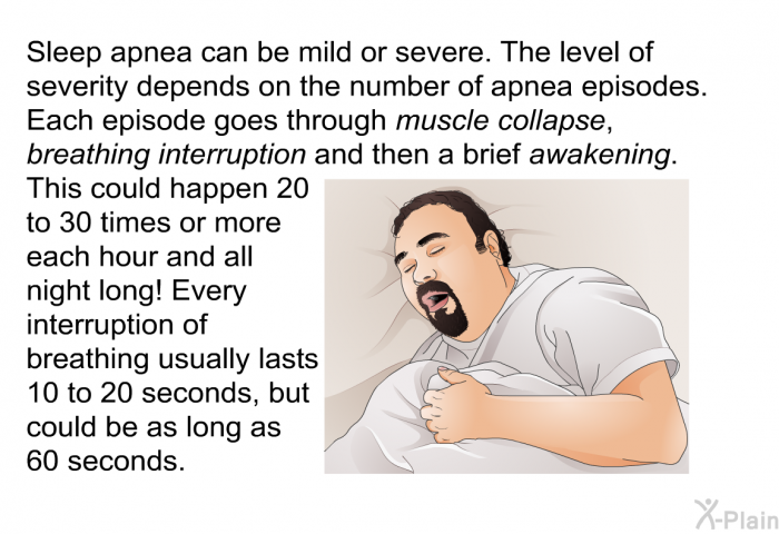 Sleep apnea can be mild or severe. The level of severity depends on the number of apnea episodes. Each episode goes through <I>muscle collapse</I>, <I>breathing interruption</I> and then a brief <I>awakening</I>. This could happen 20 to 30 times or more each hour and all night long! Every interruption of breathing usually lasts 10 to 20 seconds, but could be as long as 60 seconds.