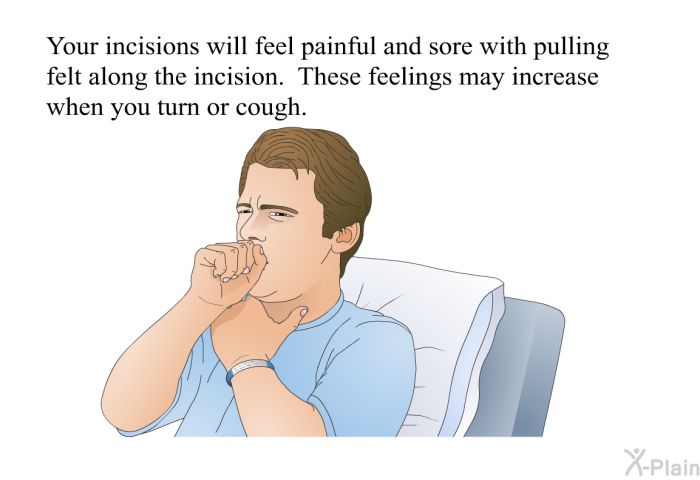 Your incisions will feel painful and sore with pulling felt along the incision. These feelings may increase when you turn or cough.