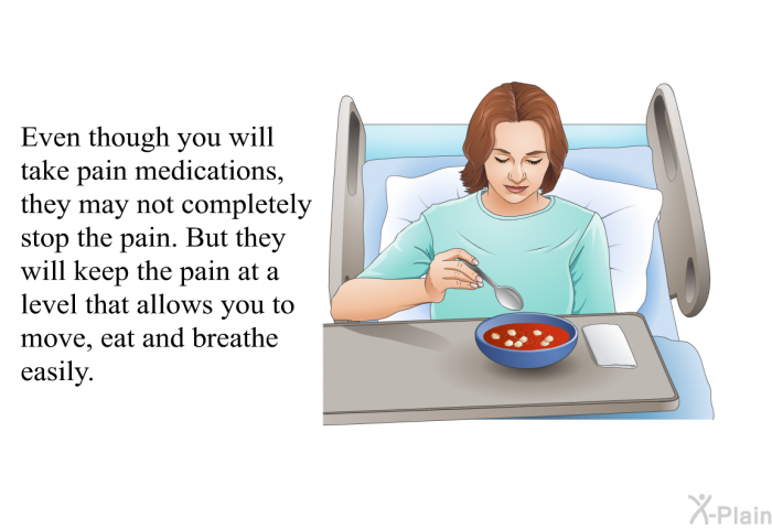 Even though you will take pain medications, they may not completely stop the pain. But they will keep the pain at a level that allows you to move, eat and breathe easily.