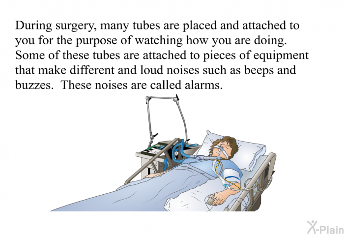 During surgery, many tubes are placed and attached to you for the purpose of watching how you are doing. Some of these tubes are attached to pieces of equipment that make different and loud noises such as beeps and buzzes. These noises are called alarms.