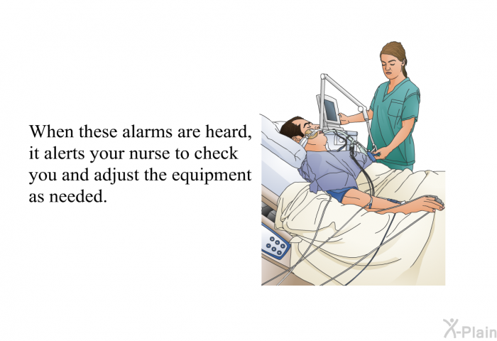When these alarms are heard, it alerts your nurse to check you and adjust the equipment as needed.