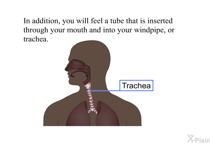 In addition, you will feel a tube that is inserted through your mouth and into your windpipe, or trachea.