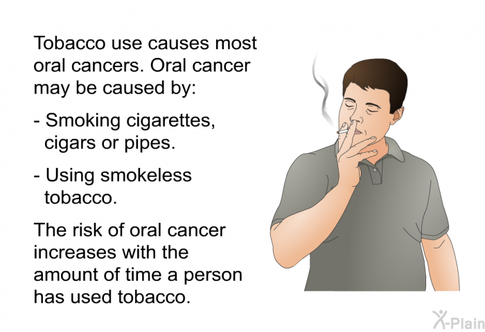 Tobacco use causes most oral cancers. Oral cancer may be caused by:  Smoking cigarettes, cigars or pipes. Using smokeless tobacco.  
 The risk of oral cancer increases with the amount of time a person has used tobacco.