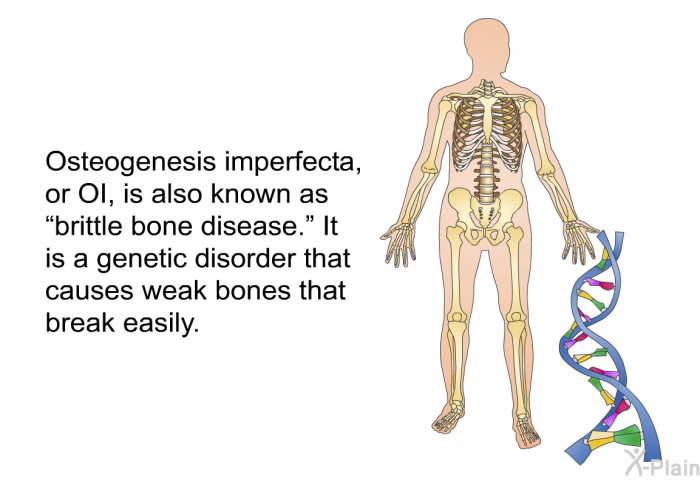 Osteogenesis imperfecta, or OI, is also known as “brittle bone disease.” It is a genetic disorder that causes weak bones that break easily.
