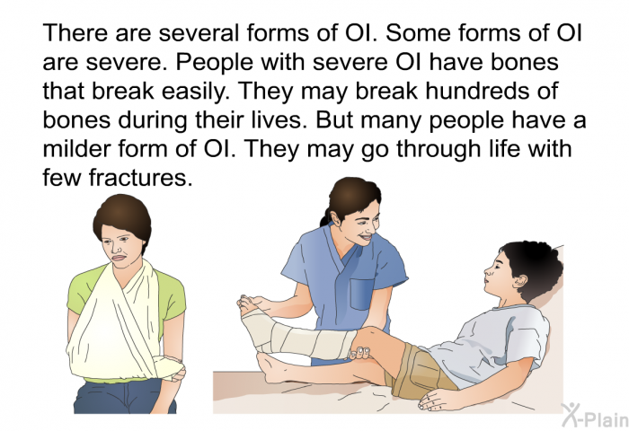 There are several forms of OI. Some forms of OI are severe. People with severe OI have bones that break easily. They may break hundreds of bones during their lives. But many people have a milder form of OI. They may go through life with few fractures.