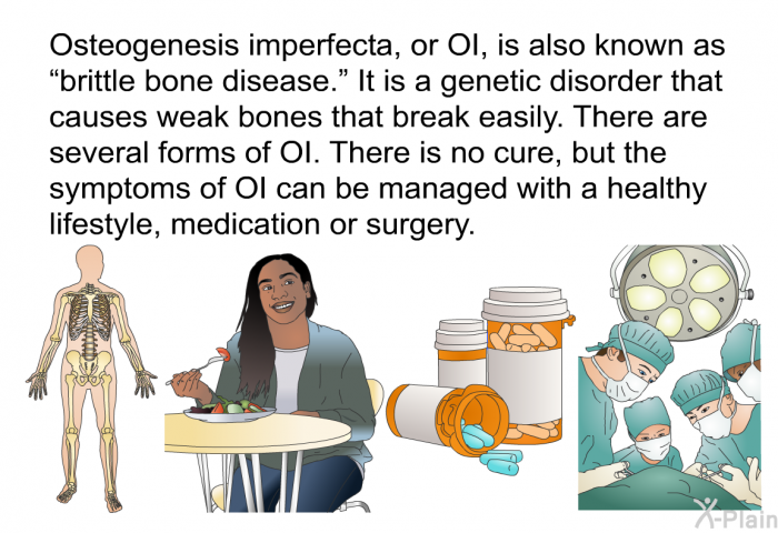 Osteogenesis imperfecta, or OI, is also known as “brittle bone disease.” It is a genetic disorder that causes weak bones that break easily. There are several forms of OI. There is no cure, but the symptoms of OI can be managed with a healthy lifestyle, medication or surgery.