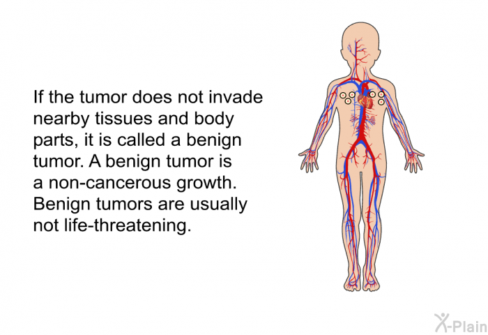 If the tumor does not invade nearby tissues and body parts, it is called a benign tumor. A benign tumor is a non-cancerous growth. Benign tumors are usually not life-threatening.