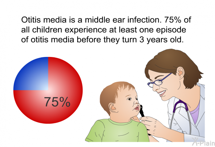 Otitis media is a middle ear infection. 75% of all children experience at least one episode of otitis media before they turn 3 years old.
