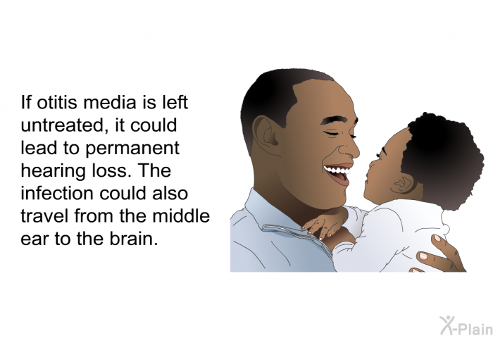 If otitis media is left untreated, it could lead to permanent hearing loss. The infection could also travel from the middle ear to the brain.