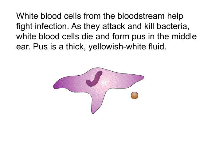 White blood cells from the bloodstream help fight infection. As they attack and kill bacteria, white blood cells die and form pus in the middle ear. Pus is a thick, yellowish-white fluid.