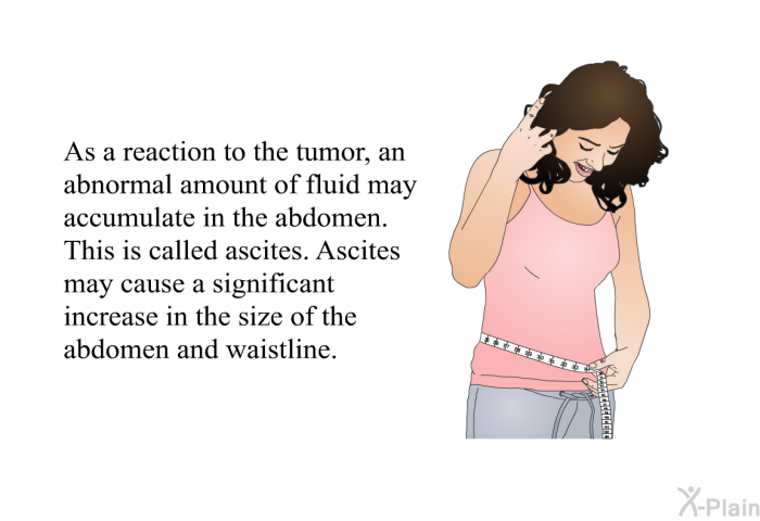 As a reaction to the tumor, an abnormal amount of fluid may accumulate in the abdomen. This is called ascites. Ascites may cause a significant increase in the size of the abdomen and waistline.