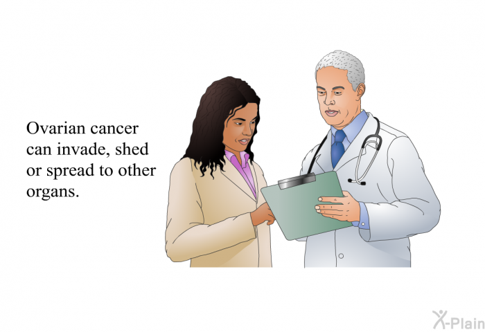 Ovarian cancer can invade, shed or spread to other organs.