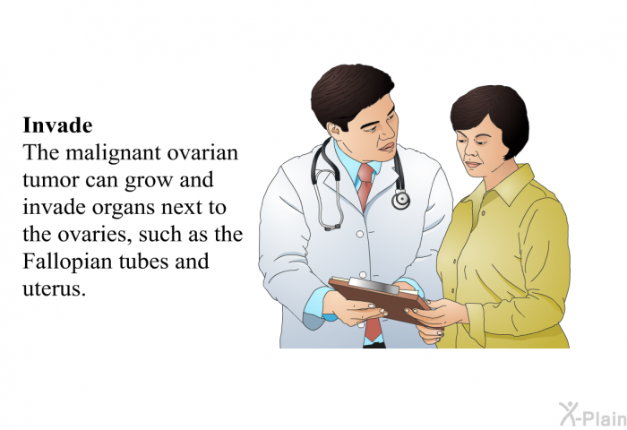 Invade - The malignant ovarian tumor can grow and invade organs next to the ovaries, such as the Fallopian tubes and uterus.
