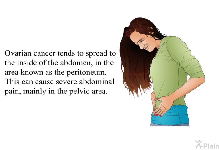 Ovarian cancer tends to spread to the inside of the abdomen, in the area known as the peritoneum. This can cause severe abdominal pain, mainly in the pelvic area.