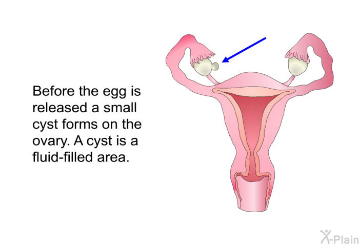 Before the egg is released a small cyst forms on the ovary. A cyst is a fluid-filled area.