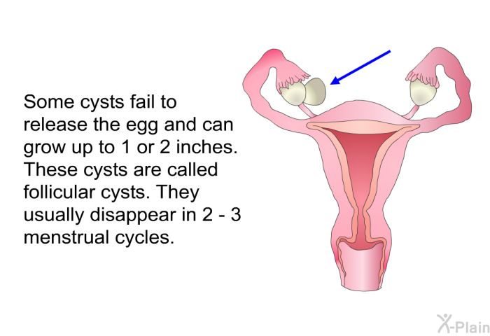 Some cysts fail to release the egg and can grow up to 1 or 2 inches. These cysts are called follicular cysts. They usually disappear in 2 - 3 menstrual cycles.
